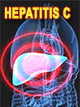 Epidemiološke i kliničke karakteristike Hepatitis C virusne infekcije